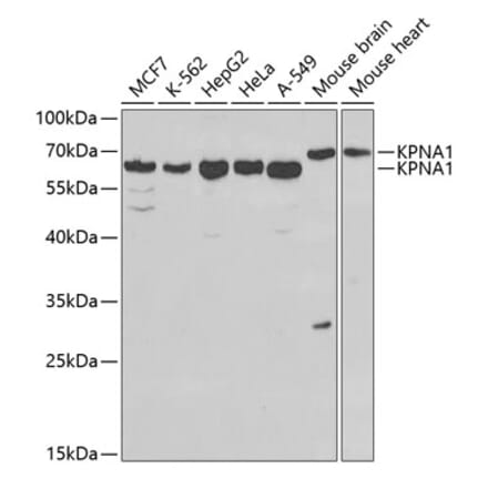 Western Blot - Anti-KPNA1 Antibody (A13627) - Antibodies.com