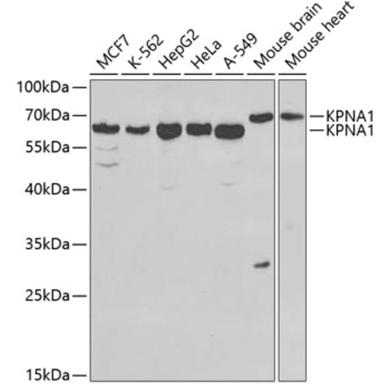 Western Blot - Anti-KPNA1 Antibody (A13627) - Antibodies.com