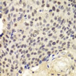 Immunohistochemistry - Anti-KPNA1 Antibody (A13627) - Antibodies.com