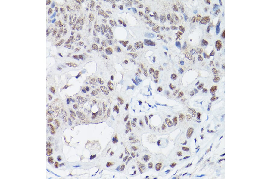 Immunohistochemistry - Anti-DNA Ligase IV/LIG4 Antibody (A13628) - Antibodies.com