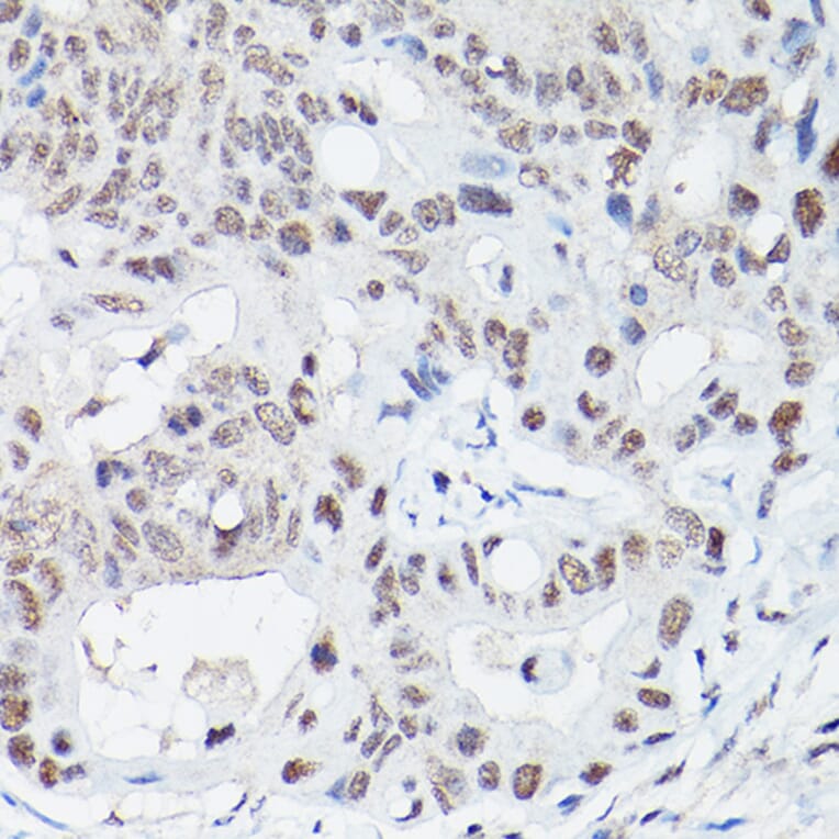 Immunohistochemistry - Anti-DNA Ligase IV/LIG4 Antibody (A13628) - Antibodies.com