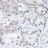 Immunohistochemistry - Anti-DNA Ligase IV/LIG4 Antibody (A13628) - Antibodies.com