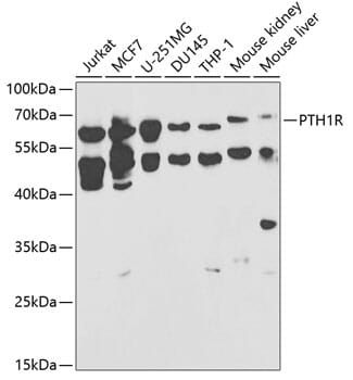 Western blot analysis of extracts of various cell lines, using Anti-PTH1R Antibody (A1744) at 1:1,000 dilution.
Secondary antibody: Goat Anti-Rabbit IgG (H+L) (HRP) (AS014) at 1:10,000 dilution.
Lysates / proteins: 25µg per lane.
Blocking buffer: 3% non-fat dry milk in TBST.