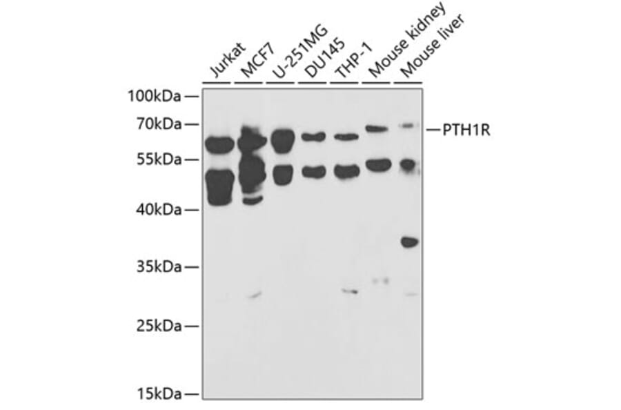 Western Blot - Anti-Parathyroid Hormone Receptor 1/PTH1R Antibody (A13629) - Antibodies.com