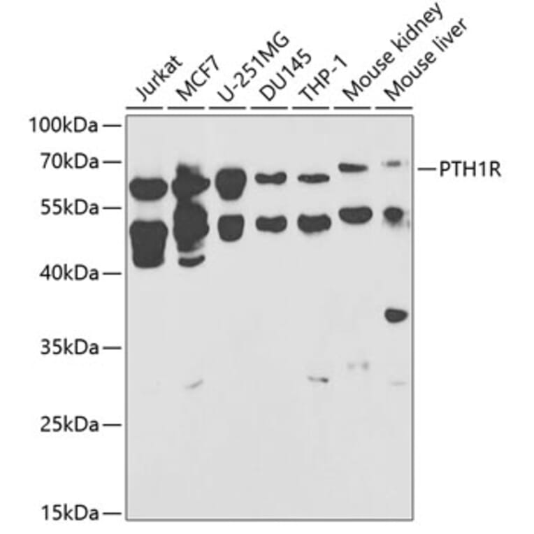 Western Blot - Anti-Parathyroid Hormone Receptor 1/PTH1R Antibody (A13629) - Antibodies.com