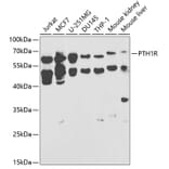 Western Blot - Anti-Parathyroid Hormone Receptor 1/PTH1R Antibody (A13629) - Antibodies.com