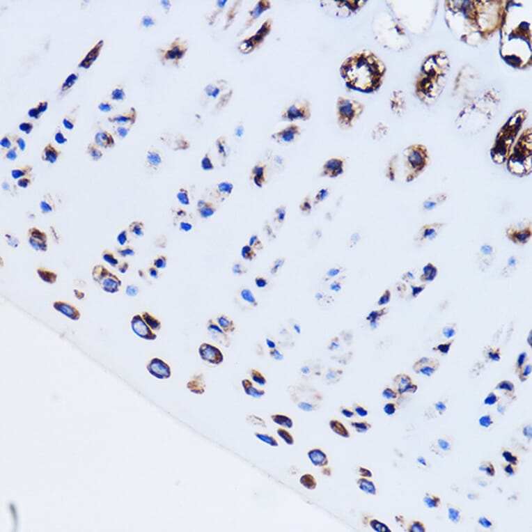 Immunohistochemistry - Anti-Parathyroid Hormone Receptor 1/PTH1R Antibody (A13629) - Antibodies.com