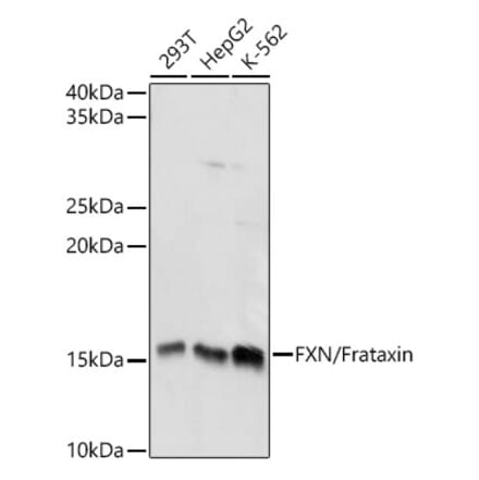 Western Blot - Anti-Frataxin Antibody (A13630) - Antibodies.com