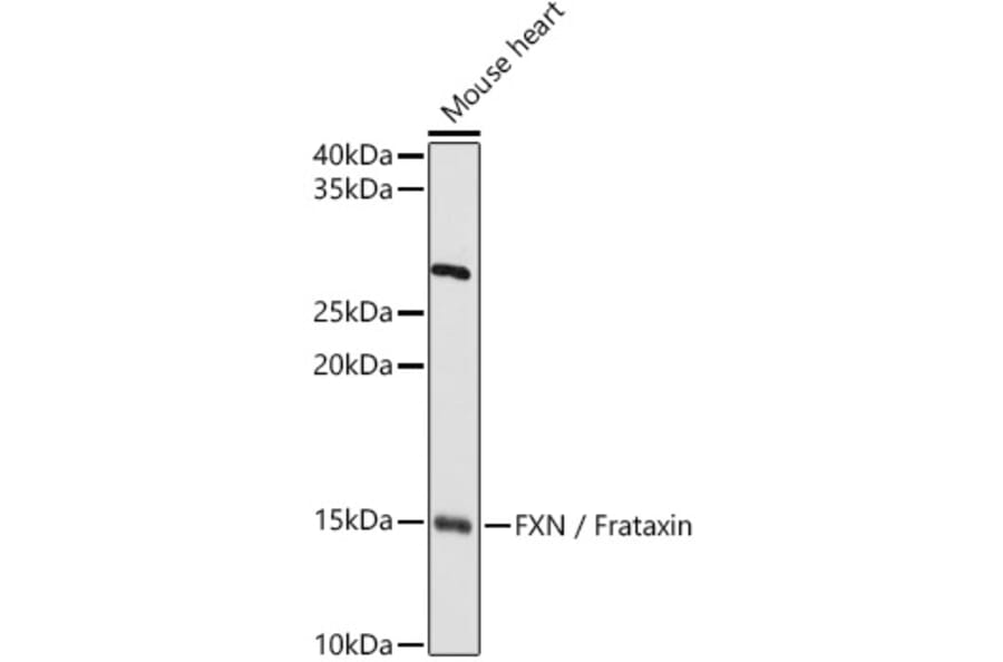 Western Blot - Anti-Frataxin Antibody (A13630) - Antibodies.com