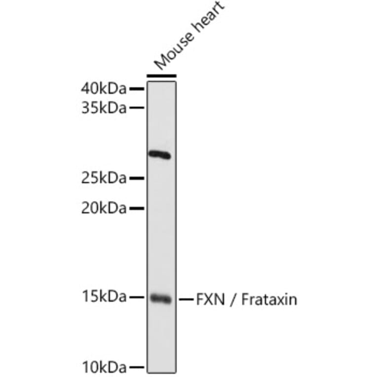 Western Blot - Anti-Frataxin Antibody (A13630) - Antibodies.com