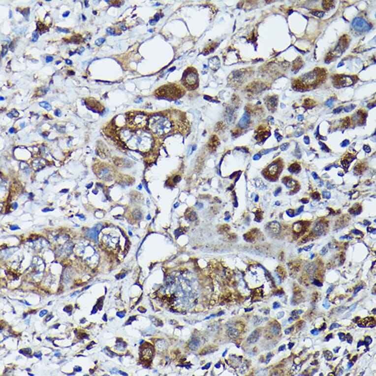 Immunohistochemistry - Anti-Frataxin Antibody (A13630) - Antibodies.com