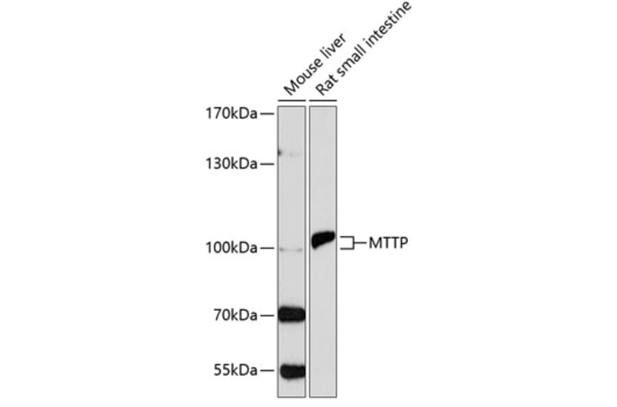 Western Blot - Anti-MTTP/MTP Antibody (A13631) - Antibodies.com