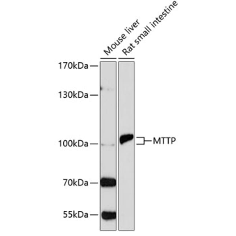 Western Blot - Anti-MTTP/MTP Antibody (A13631) - Antibodies.com