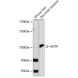 Western Blot - Anti-MTTP/MTP Antibody (A13631) - Antibodies.com