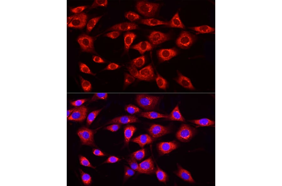 Immunofluorescence - Anti-MTTP/MTP Antibody (A13631) - Antibodies.com
