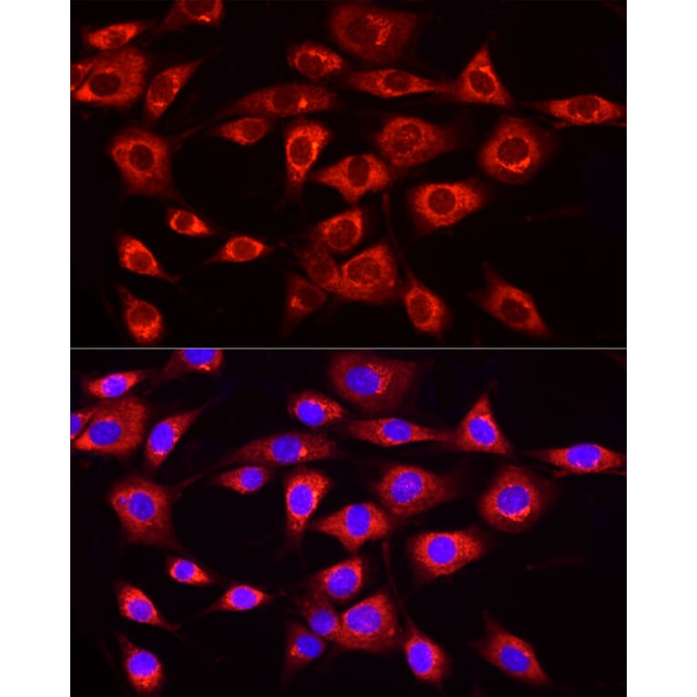 Immunofluorescence - Anti-MTTP/MTP Antibody (A13631) - Antibodies.com