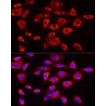 Immunofluorescence - Anti-MTTP/MTP Antibody (A13631) - Antibodies.com
