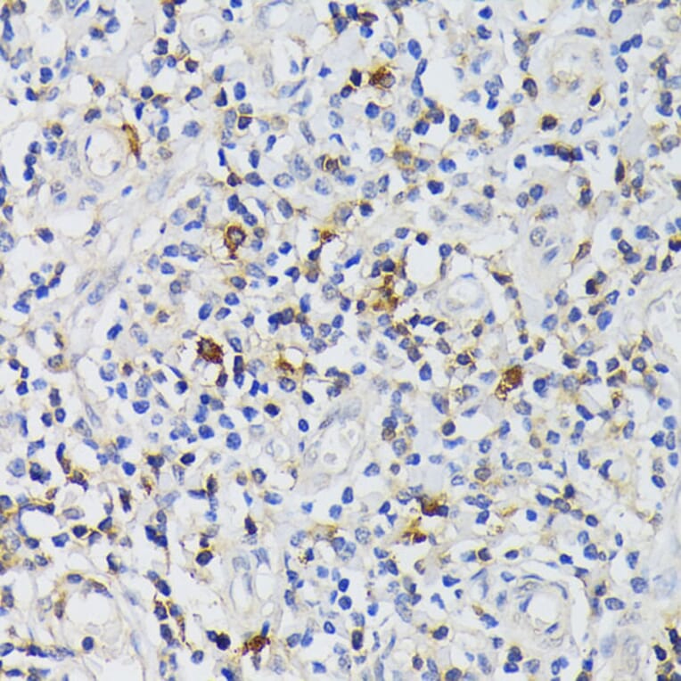 Immunohistochemistry - Anti-CD3 epsilon Antibody (A13633) - Antibodies.com