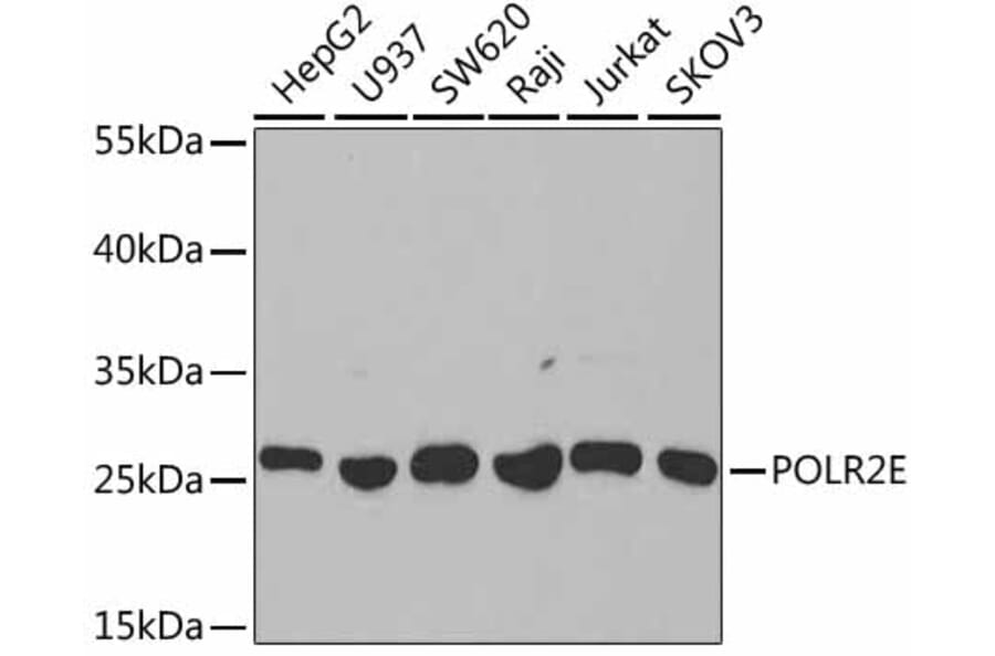 Western Blot - Anti-POLR2E/rpb5 Antibody (A13634) - Antibodies.com