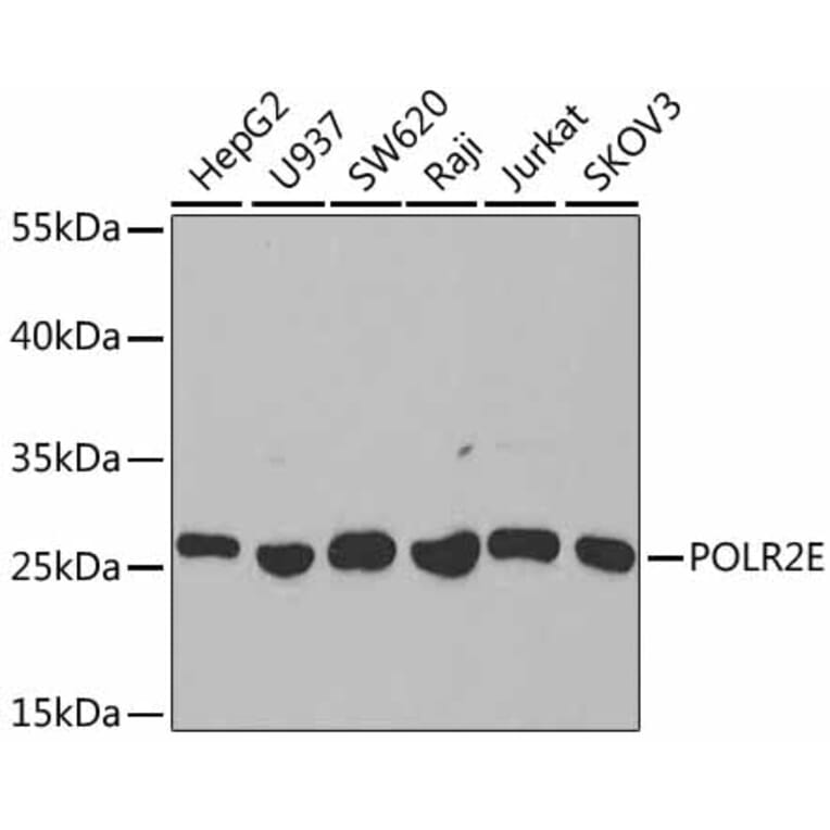 Western Blot - Anti-POLR2E/rpb5 Antibody (A13634) - Antibodies.com