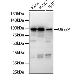 Western Blot - Anti-UBE3A Antibody (A13635) - Antibodies.com