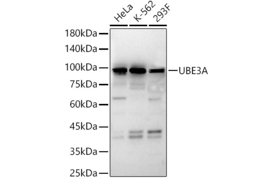 Western Blot - Anti-UBE3A Antibody (A13635) - Antibodies.com