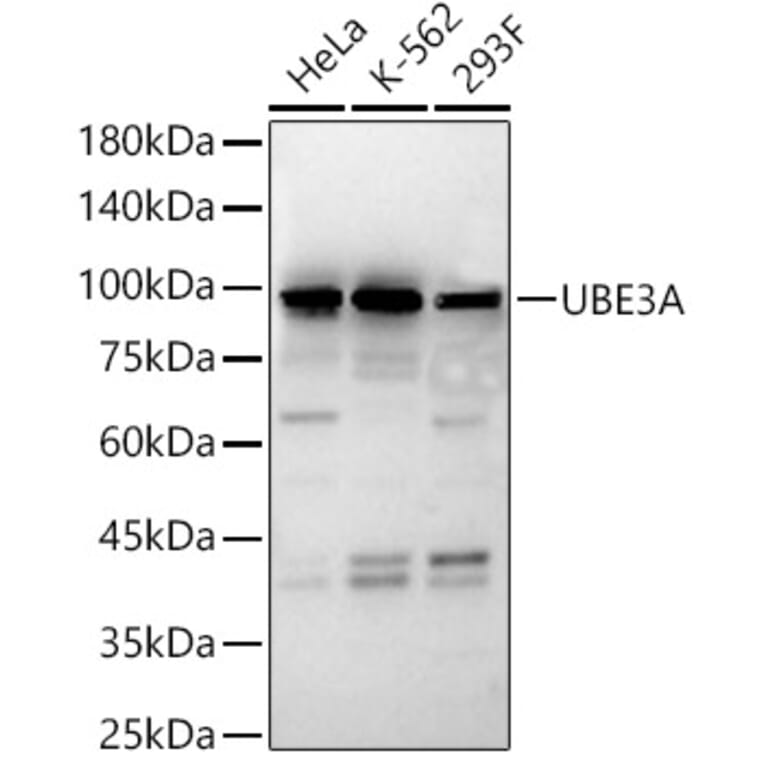 Western Blot - Anti-UBE3A Antibody (A13635) - Antibodies.com