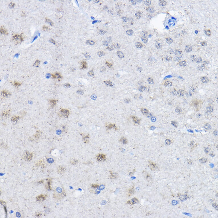 Immunohistochemistry - Anti-UBE3A Antibody (A13635) - Antibodies.com