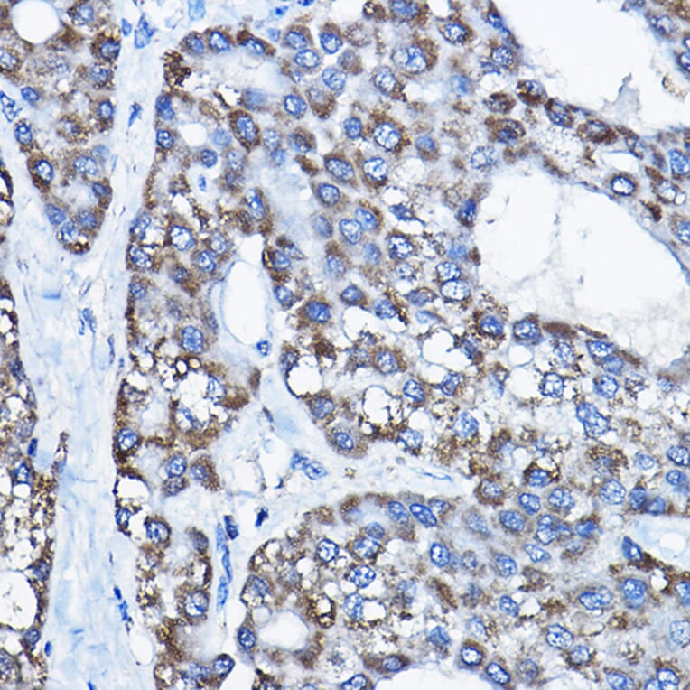 Immunohistochemistry - Anti-UBE3A Antibody (A13635) - Antibodies.com