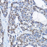 Immunohistochemistry - Anti-UBE3A Antibody (A13635) - Antibodies.com