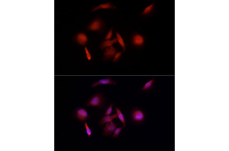 Immunofluorescence - Anti-UBE3A Antibody (A13635) - Antibodies.com