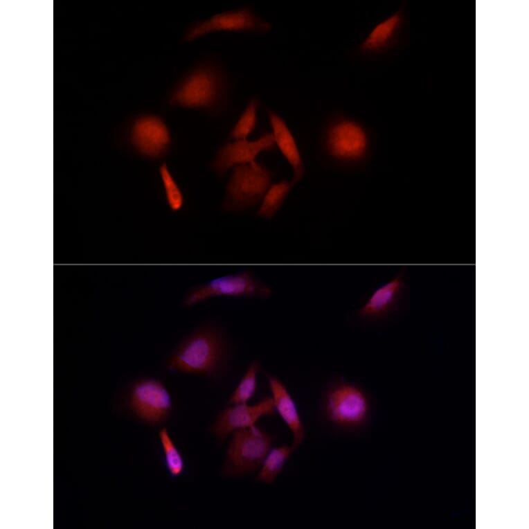 Immunofluorescence - Anti-UBE3A Antibody (A13635) - Antibodies.com