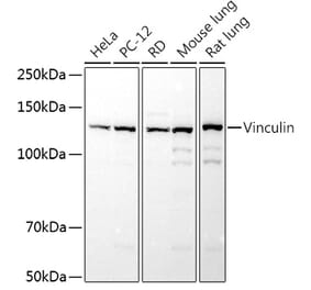 Western Blot - Anti-Vinculin Antibody (A13636) - Antibodies.com