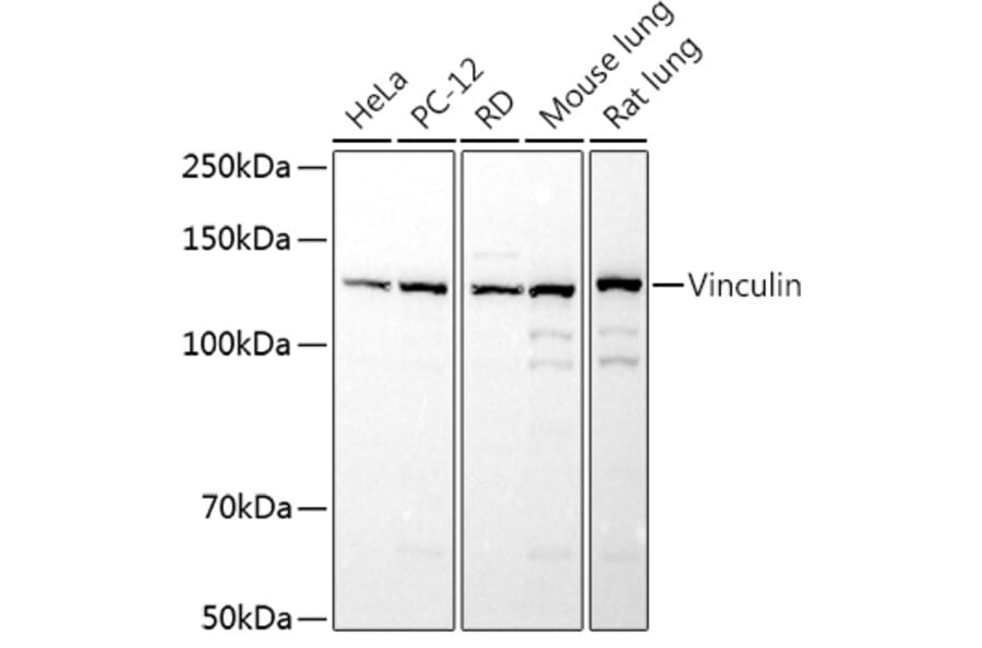 Western Blot - Anti-Vinculin Antibody (A13636) - Antibodies.com