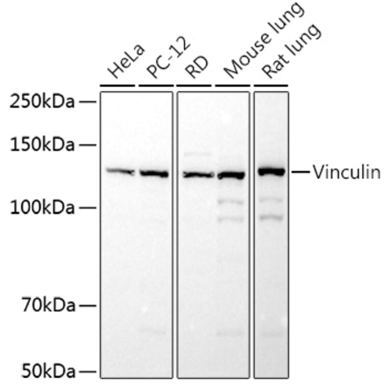 Western Blot - Anti-Vinculin Antibody (A13636) - Antibodies.com