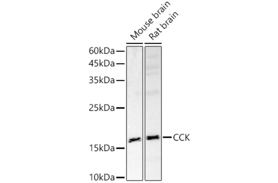 Western Blot - Anti-Cholecystokinin Antibody (A13637) - Antibodies.com