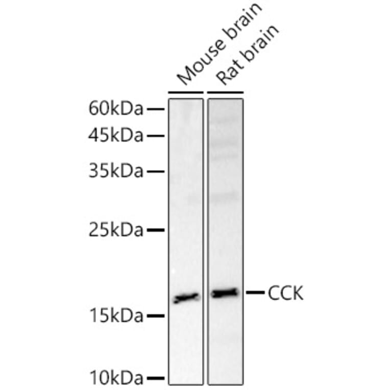 Western Blot - Anti-Cholecystokinin Antibody (A13637) - Antibodies.com