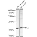 Western Blot - Anti-Cholecystokinin Antibody (A13637) - Antibodies.com