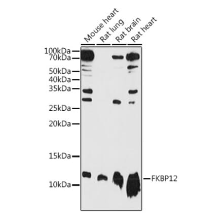 Western Blot - Anti-FKBP12 Antibody (A13639) - Antibodies.com