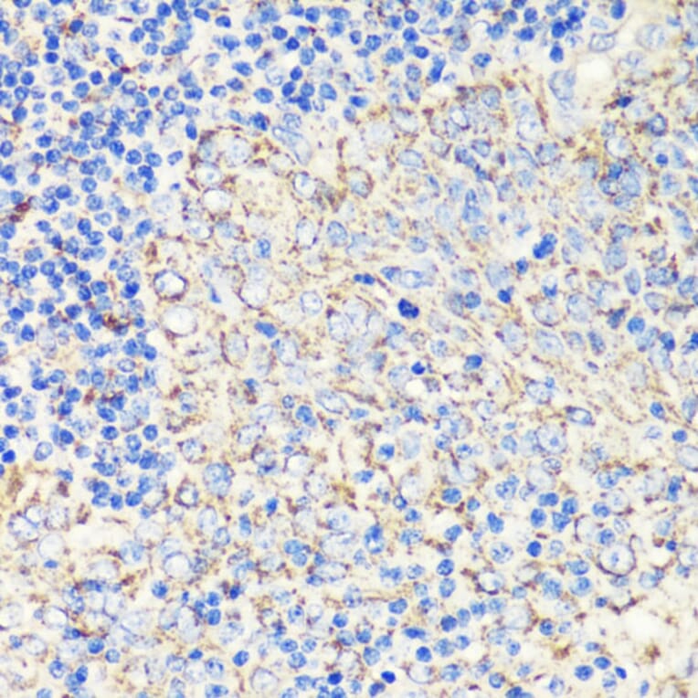 Immunohistochemistry - Anti-FKBP12 Antibody (A13639) - Antibodies.com