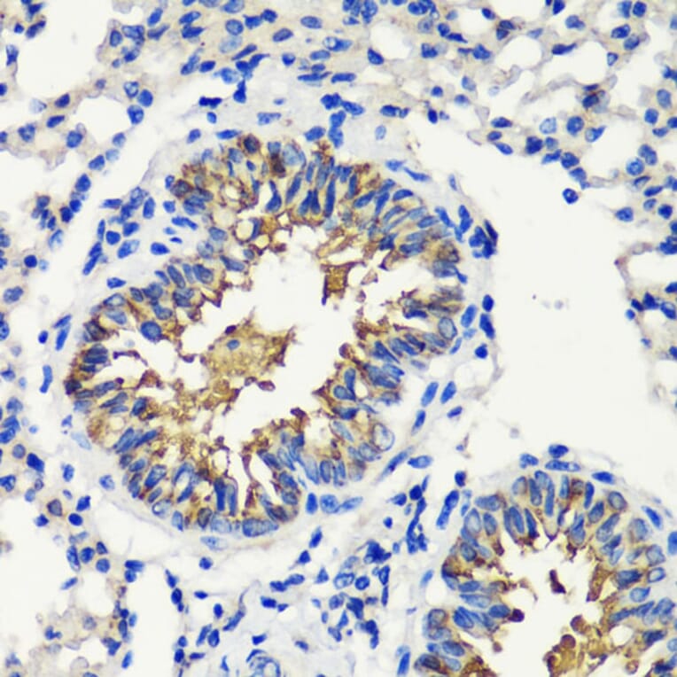 Immunohistochemistry - Anti-FKBP12 Antibody (A13639) - Antibodies.com