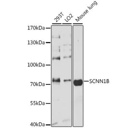Western Blot - Anti-SCNN1B Antibody (A13641) - Antibodies.com