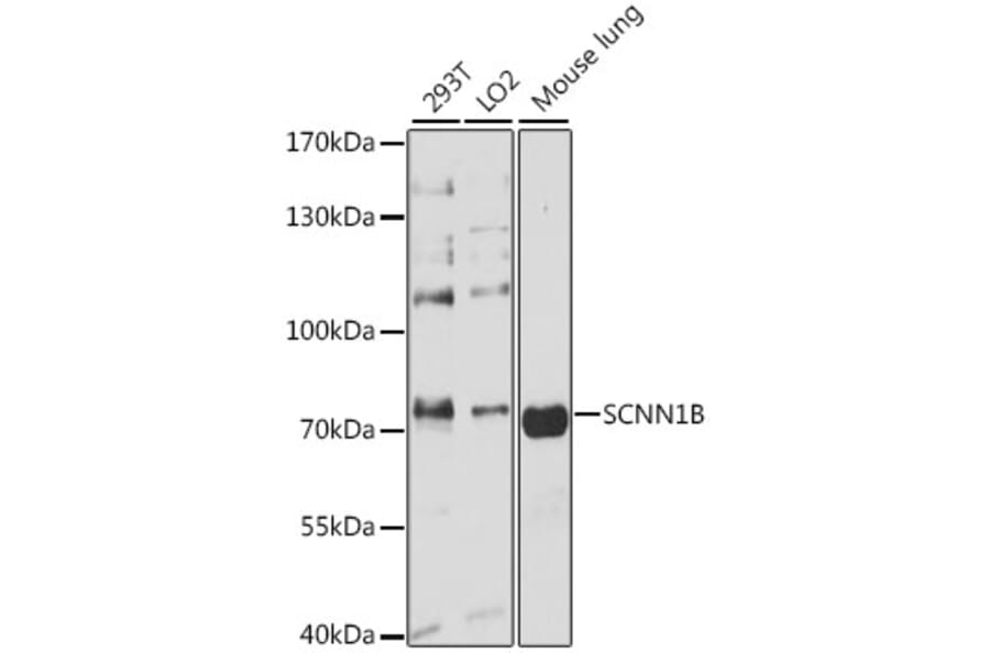 Western Blot - Anti-SCNN1B Antibody (A13641) - Antibodies.com