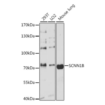Western Blot - Anti-SCNN1B Antibody (A13641) - Antibodies.com