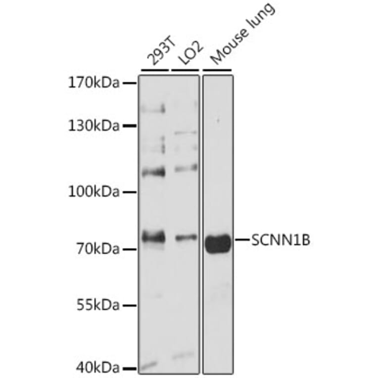 Western Blot - Anti-SCNN1B Antibody (A13641) - Antibodies.com