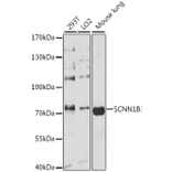 Western Blot - Anti-SCNN1B Antibody (A13641) - Antibodies.com