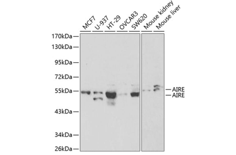 Western Blot - Anti-AIRE Antibody (A13643) - Antibodies.com