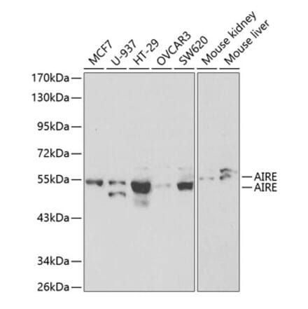 Western Blot - Anti-AIRE Antibody (A13643) - Antibodies.com