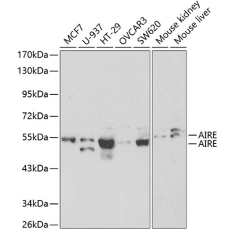 Western Blot - Anti-AIRE Antibody (A13643) - Antibodies.com