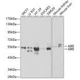 Western Blot - Anti-AIRE Antibody (A13643) - Antibodies.com